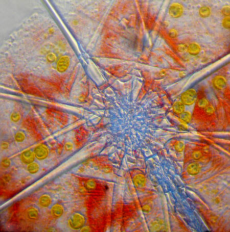 radiolaria, radiolarien, radiolarie