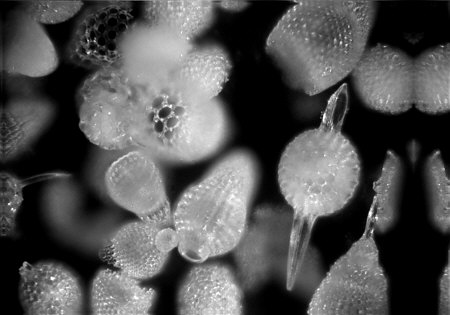 [radiolarien, radiolaria, barbados, images, foto, bild, jpg, photomicrograph]