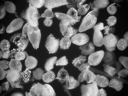 [radiolarien, radiolaria, images, foto, bild, jpg, barbados, photomicrograph]